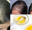MAGIC RECIPE FOR FASTEST HAIR GROWTH NATURALY, ALL ARE SURPRISED BY THE RESULTS…