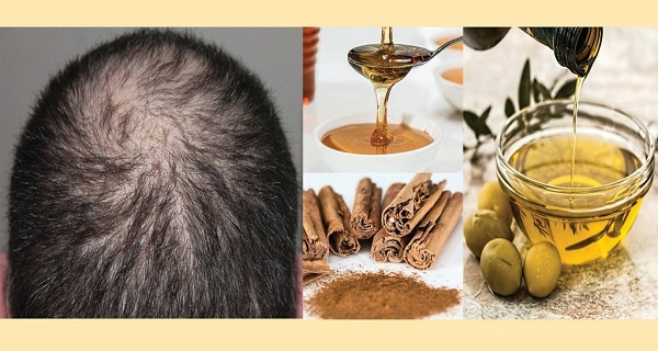 Say Goodbye To The Baldness Grow Back Your Hair Naturally, Faster and Stronger!