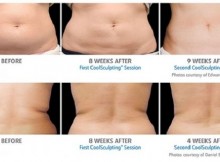 You Can Easily Kill The Fat Cells By Simply Freezing Them