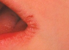 do-you-have-this-symptom-check-out-it-indicates-something-bad