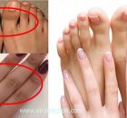 Get rid of dark finger joints with these 4 natural remedies!