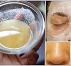 Use Baking Soda To Make Your Face And Skin Beautiful!