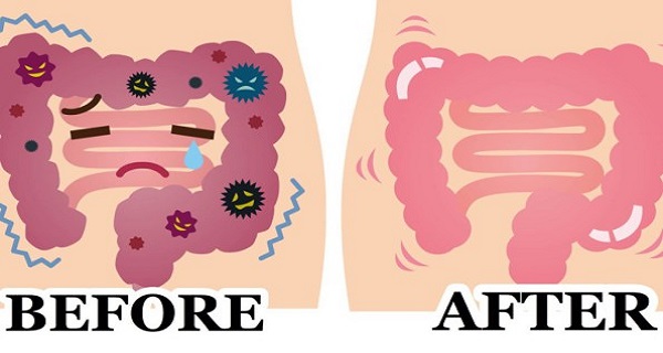 This-2-Ingredient-Remedy-Flushes-POUNDS-of-Waste-From-Your-Colon