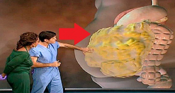 Do You Have Excess Fat On Your Stomach Here`s How To Remove It!