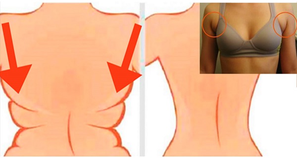 HOW TO GET RID OF BACK FAT AND UNDERARM FLAB WITH THESE 4 QUICK EXERCISES!