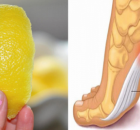 PEEL OF LEMON CAN REMOVE JOINT PAIN FOREVER