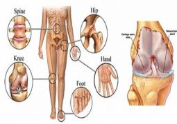 this-is-why-your-joints-hurts-and-how-you-can-relieve-the-pain