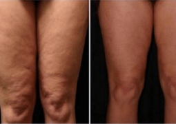 what-she-spreads-on-her-skin-everyone-has-at-home-but-nobody-uses-it