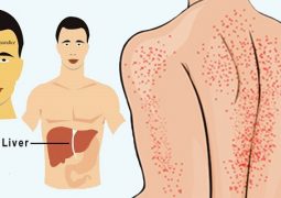 12-ways-your-body-tries-to-tell-you-that-your-liver-is-being-damaged