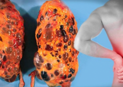 8-bad-habits-that-can-damage-your-kidneys-and-you-do-them-every-day-you-should-start-avoiding-them-immediately