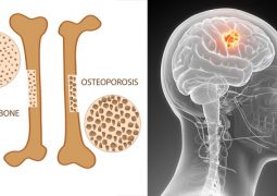 this-common-drink-destroys-your-bones-and-is-full-of-cancer-causing-chemicals
