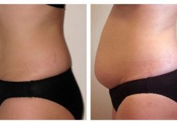 top-4-causes-of-menopausal-weight-gain-and-how-to-prevent-it