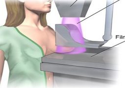 when-your-doctor-suggests-regular-mammograms-this-is-what-you-need-to-say-back
