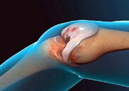 doctors-amazed-recipe-renews-knees-joints