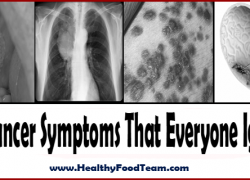10 Cancer Symptoms That Everyone Ignore